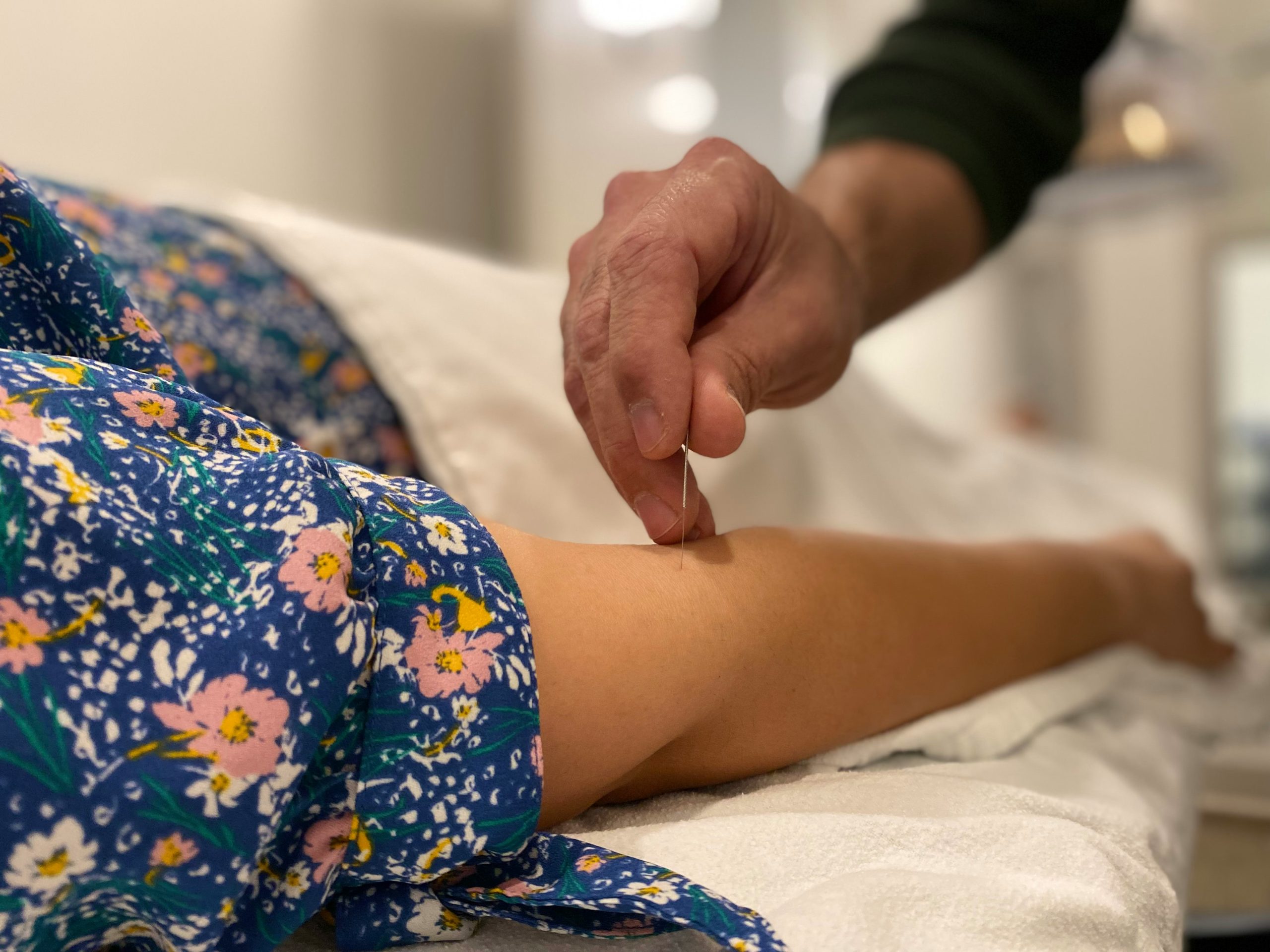 acupuncture manchester - woman getting acupuncture