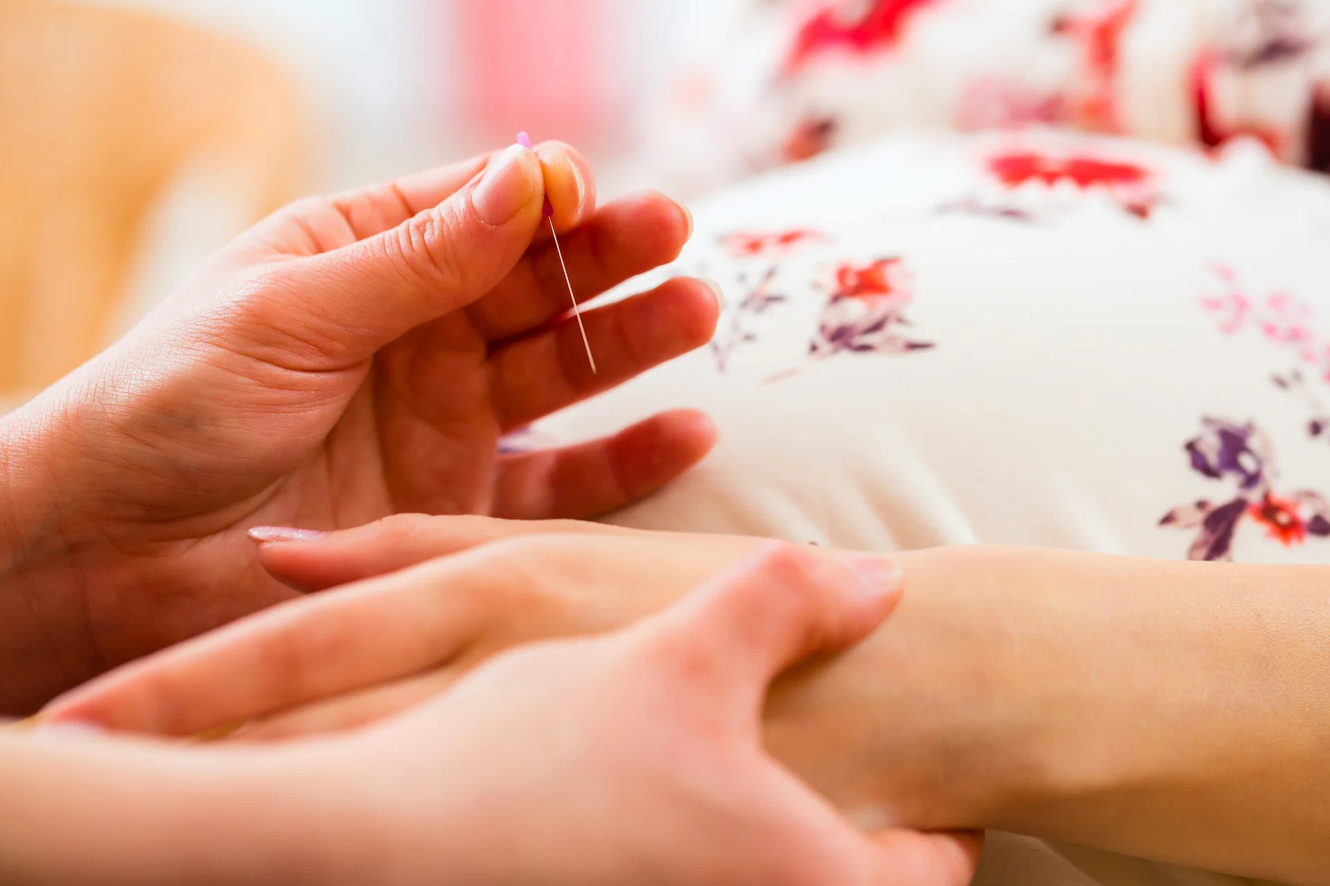 acupuncture manchester